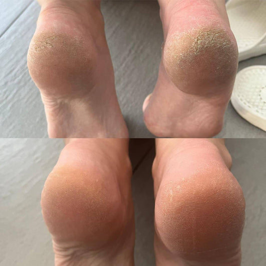 Crème Pieds à la Bave d'Escargot Aurodhea