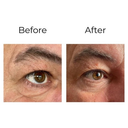 Contour des yeux anti-rides «effet young look » avec TIBOTOH-X™ - 15 ml