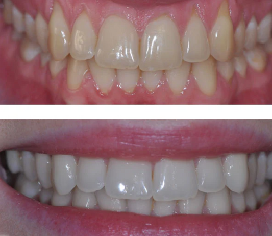 Dentifrice blanchissant à l'Aloe vera (format voyage) | Enrichi en Propolis et Xylitol