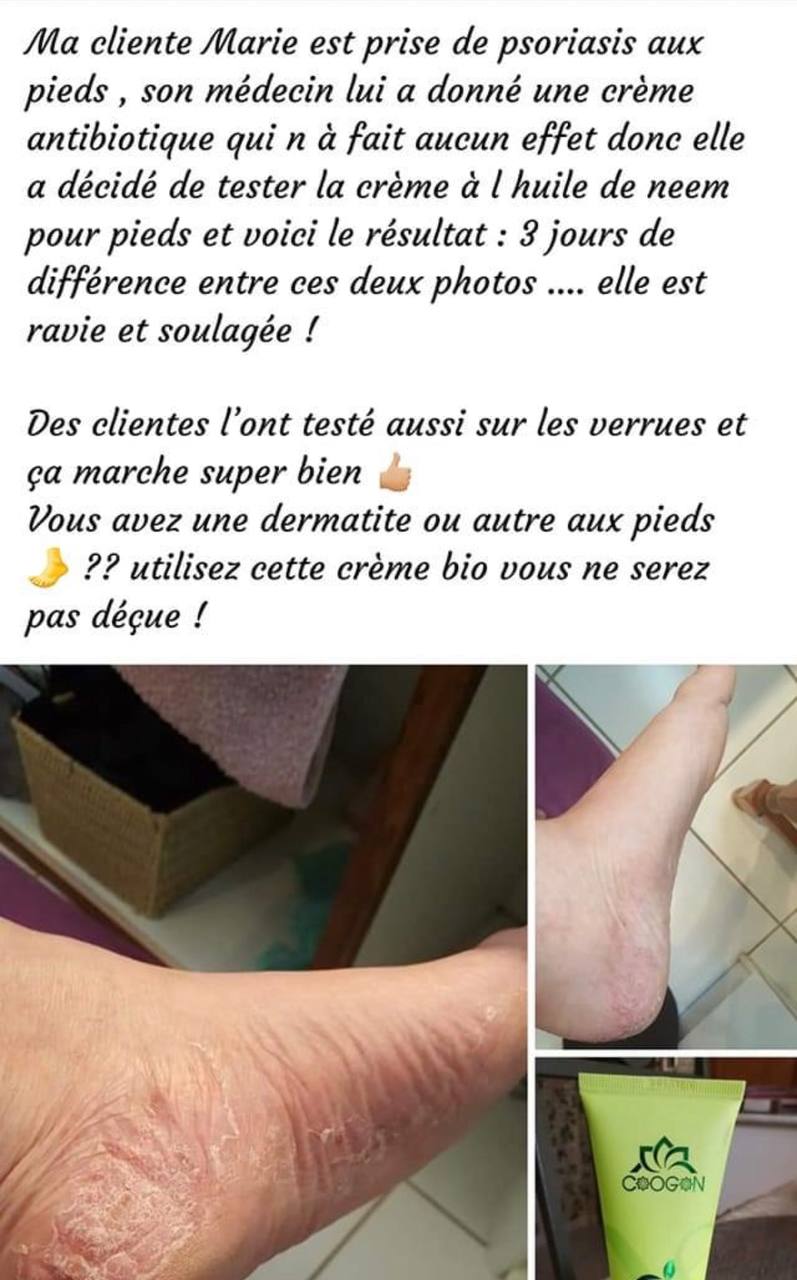 Crème Pieds à l'Huile de Neem Aurodhea – 75ml
